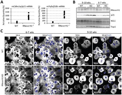 Top1 levels are increased in Rnaseh1-knockout mice to reduce nucleolar accumulation of R-loops. (A) qRT-PCR of Cdkn1a/p21 and Tnfrsf10b from isolated primary mouse hepatocytes. 10 animals per group were assayed. (B) Western analysis of RNase H1, p21 and Top1 in liver lysates from control mice and Rnaseh1-knockout mice that were either 6–7 weeks old (two animals/group) or 9–10 weeks old (three animals/group). (C) Representative images of immunofluorescent staining of S9.6 in isolated mouse hepatocytes.