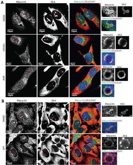 RNase H1 and DNA:RNA hybrids co-migrate to perinucleolar regions upon RNAP I transcriptional arrest or nucleolar segregation. (A and B) Representative images of co-immunofluorescent staining of endogenous RNase H1 and R-loops (using S9.6) in HeLa cells treated with (A) RNAP I transcriptional inhibitors CX5461 (250 nM, 6 h), ActD (0.02 μg/ml, 2 h), or (B) Top1 inhibitor CPT (10 μM, 4 h). Images were adjusted to allow the optimal representation of nucleolar ring structures.