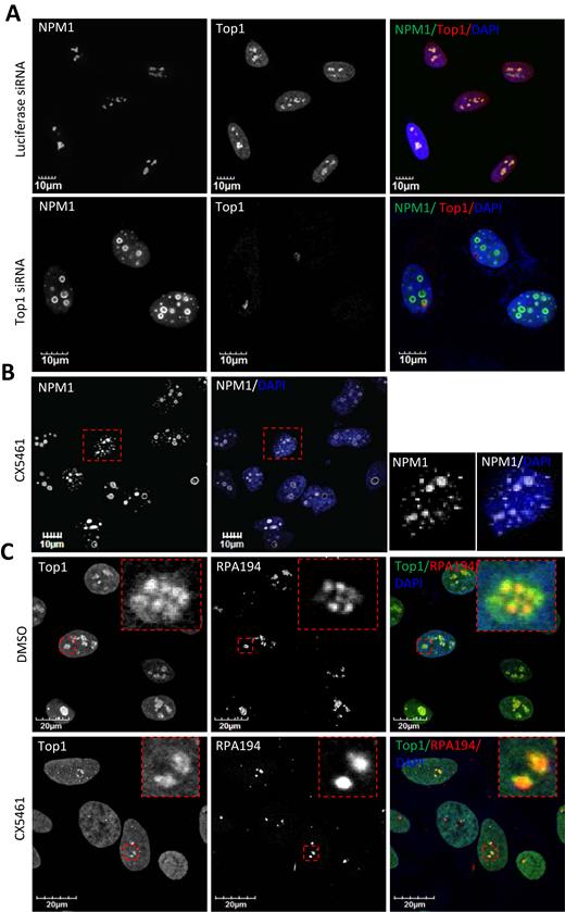 Top1 and RPA194 co-migrate to perinucleolar LNCs upon RNAP I transcriptional arrest and nucleolar segregation. (A) Confocal immunofluorescence imaging of HeLa cells 48 h after transfection with luciferase siRNA or Top1 siRNA. Cells were stained for Top1 and nucleolar marker NPM1. (B) HeLa cells treated with 250 nM CX5461 for 6 h were stained for NPM1. (C) Co-immunofluorescent staining of Top1 and RPA194 in HeLa cells treated with DMSO or 250 nM CX5461 (6 h).