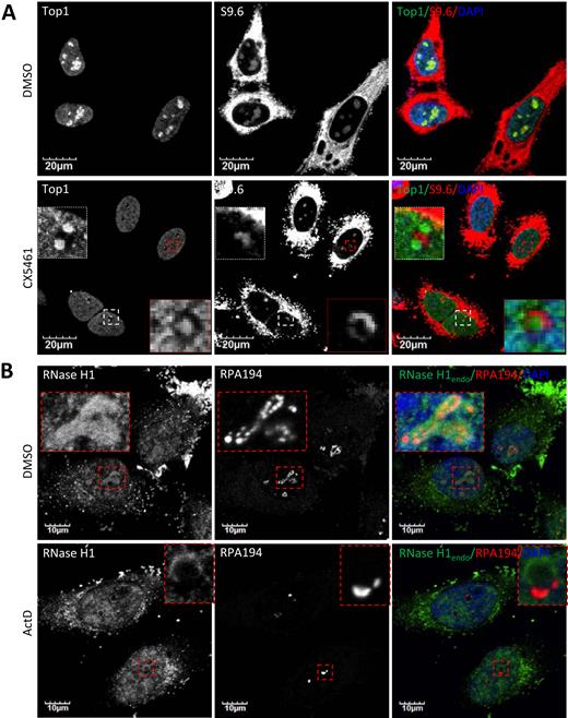 Top1 and RNase H1 localize to different perinucleolar sites upon RNAP I transcriptional arrest. (A) Co-immunofluorescent staining of Top1 and R-loops in HeLa cells treated with DMSO or 250 nM CX5461 (6 h). (B) Co-immunofluorescent staining of endogenous RNase H1 and RPA194 in HeLa cells treated with DMSO or 0.02 μg/ml ActD (2 h).