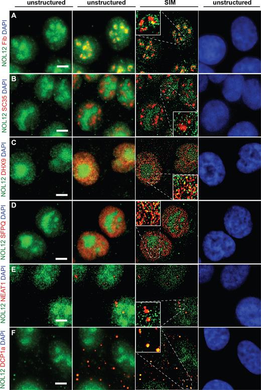 Nol12 localizes to different subcellular structures. Localization of endogenous Nol12 in HCT116 WT cells. HCT116 cells were grown on poly-l-lysine-coated glass coverslips, fixed, permeabilized, and incubated for immunofluorescence (IF) (A–C, D, F), or immunofluorescence-fluorescence in situ hybridization (IF-FISH) (E) with antibodies against the indicated proteins (Supplementary Table S7) and/or fluorescently-labeled probes against NEAT1_1/2. Endogenous Nol12 localization was compared to that of the nucleolar marker Fibrillarin (A), the splicing factor SC35 (B), the nuclear DNA/RNA helicase Dhx9 (C), the paraspeckle component SFPQ (D), the lncRNA NEAT1_1/2 (E), and GW/P-body component Dcp1a (F). DNA was visualized by DAPI staining. Cells were imaged using Structured Illumination Microscopy (SIM) and raw (unstructured) and SIM images were computed and processed using Zen SP1 Black Software and the Fiji package of ImageJ. Scale bar = 5 μm.