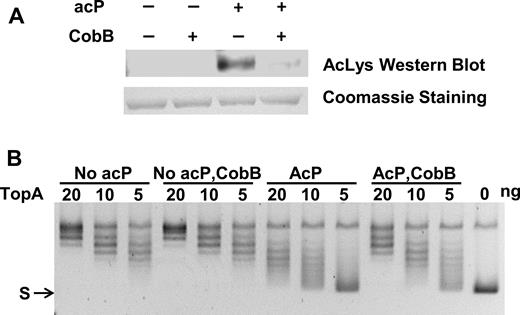 CobB deacetylation counters the effect of acetyl phosphate mediated lysine acetylation on TopA relaxation activity. Purified E. coli TopA (1 μg) and 2 mM acP was incubated with or without CobB (0.65:1 molar ratio to TopA) at 37°C for 4 h. (A) Acetylation level of TopA was compared by western blot analysis with anti-acetyllysine antibody. TopA protein was visualized by Coomassie blue staining. (B) Following incubation with acetyl phosphate in the absence or presence of CobB, serial dilutions of TopA (20, 10, 5 ng) were incubated with 150 ng negatively supercoiled plasmid DNA (S) at 37°C for 30 min to assay the TopA relaxation activity.