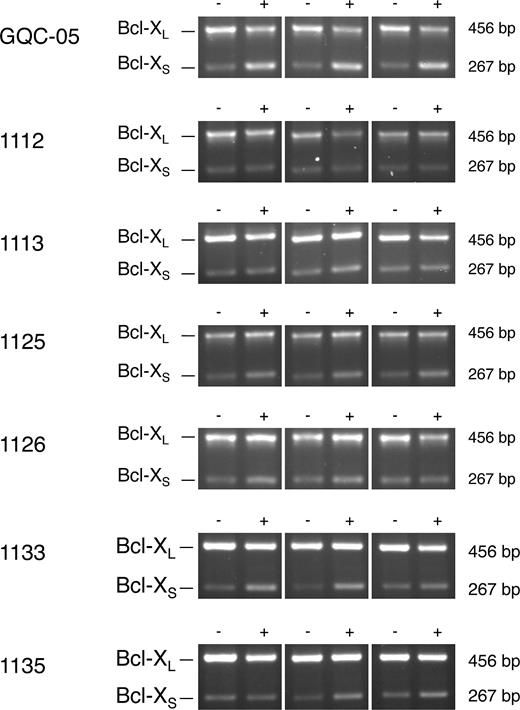 Effects of GQC-05 and other ellipticines on splicing of endogenous Bcl-X transcripts in HeLa cells. The cells were incubated with the compound at 10 μM for 4 h, followed by isolation of the RNA and amplification by reverse transcriptase-PCR. The products were separated by agarose gel electrophoresis and detected by ethidium bromide. The experiments were done in triplicate. Reactions done in parallel with reaction mixtures lacking reverse transcriptase were blank and have been omitted.
