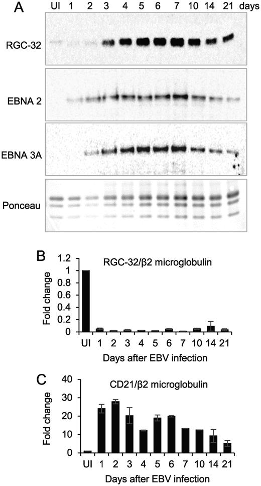 Pumilio Directs Deadenylation Ociated Translational Repression Of Ysis Of Rgc 32 Expression On Ebv Infection Naïve B Cells Cd19 Positive