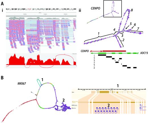 Complex gene graph structure. (A) Mis-assembly of reads from overlapping genes. (Ai) IGV visualization of CENPO exon 8 together with corresponding Sashimi plot. ADCY3 overlaps with CENPO on the opposite strand of DNA. (Aii) In this case, reads derived from ADCY3 mRNA are being wrongly mapped to CENPO resulting in the complex graph structure observed in exon 8. The schematic diagram of overlapping genes CENPO and ACDY3 is shown above and regions of the graph mapped back to it. The loops in exon 8 of CENPO are formed by junction reads derived from ADCY3 encoded on the opposite strand. (B) Repeat sequences cause perturbation in graph structure. Network-based visualization of MKI67. In this graph, there are two structures: (1) an alternatively spliced exon and (2) internal duplication. Skipping of exon 6 giving rise to ENST00000368653 can be observed as the loop structure, whilst the knotted structure is formed due the presence of 16 K167/Chmadrin repeat domains within exon 12.