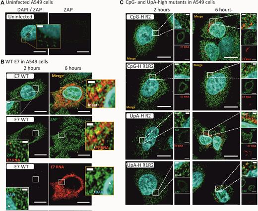 E7 entry and replication initiation in A549 cells. (A) Uninfected A549 cells co-stained for ZAP by specific antibody and GFP-coupled second antibody and for E7 RNA by FISH (assay specificity control, not detected). Nuclear DNA was stained by DAPI (blue). (B) E7 RNA detection by FISH in cells at 2 and 6 h post after infection with WT E7 co-stained for ZAP. (C) Merged images of A549 cells infected with compositionally modified mutants of E7, CpG-high in R2 or R1 and R2 combined, UpA-high in R1 or R1R2.