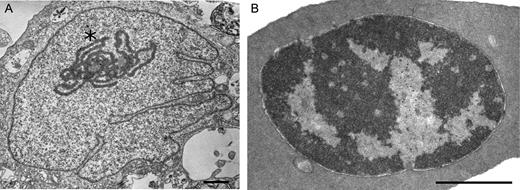 Transmission electron microscopy analysis reveals different organization of chromatin in chicken fibroblasts and erythrocytes. Representative examples of CEF and CME cells are shown on (A) and (B), respectively. Note the pronounced nucleolus in CEF cell (marked by asterisk). Scale bar: 1uM