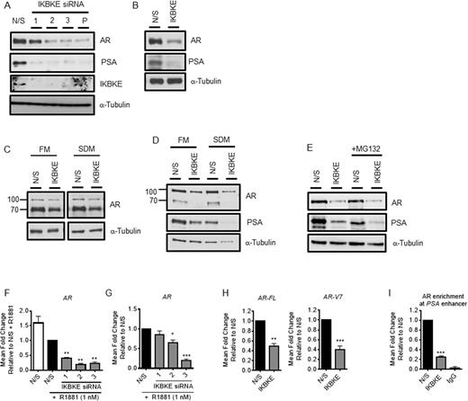 IKBKE regulates AR mRNA expression. (A) LNCaP cells were transfected in serum containing media (FM) with N/S or three individual/pooled siRNAs against IKBKE. After 72 h, (A) PSA, AR and IKBKE expression was determined by immunoblotting. (B) LNCaP-AI cells were transfected in steroid depleted media (SDM) with N/S or three pooled IKBKE siRNAs. After 72 h, PSA and AR expression was assessed by immunoblotting. (C) CWR22Rv1 and (D) VCaP cells were transfected with N/S or pooled IKBKE siRNAs and grown in either FM or SDM as indicated. After 72 h, PSA and AR expression were determined by immunoblotting. (E) LNCaP cells were transfected with N/S or pooled IKBKE siRNAs. After 40 h, the proteasomal inhibitor MG132 (20 μM) was applied for 16 h. PSA and AR expression was determined by immunoblotting. (F) LNCaP cells were transfected in SDM with N/S or three individual IKBKE siRNAs. After 72 h, R1881 was applied for 24 h then AR mRNA quantified by qPCR (n = 3). One-way ANOVA paired Dunnetts multiple comparison test. (G) LNCaP-AI cells were transfected in SDM with N/S or three individual IKBKE siRNAs. After 72 h, cells were stimulated with R1881 (1 nM) then AR mRNA expression determined at 24 h by qPCR (n = 3). One-way ANOVA paired Dunnetts multiple comparison test (H) CWR22Rv1 cells were transfected with N/S or IKBKE siRNA pool in SDM. After 72 h full length AR (AR-FL) and AR-V7 gene expression was analysed by qPCR (n = 3). Student's t-test. (I) LNCaP cells were transfected with N/S or pooled IKBKE siRNAs. After 72 h, chromatin immunoprecipitation for AR was performed and recruitment to the PSA enhancer assessed by qPCR (n = 3). One-way ANOVA paired Dunnetts multiple comparison test * P < 0.05, ** P < 0.01; *** P < 0.001. P: pooled siRNA.