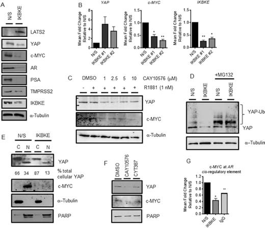IKBKE influences AR mRNA expression via the Hippo pathway. LNCaP cells were reverse transfected in full media (FM) with either N/S or three pooled siRNAs against IKBKE. After 72 h, protein expression was assessed by (A) immunoblotting and (B) YAP, c-MYC and IKBKE mRNA expression determined by qPCR (n = 3). (C) After 72 h steroid depletion, LNCaP cells were pre-treated with vehicle (DMSO) or increasing concentrations of IKBKE antagonist, CAY10576, for 8 h followed by treatment with vehicle or 1 nM R1881 for a further 24 h. YAP and c-MYC protein levels were assessed by immunoblotting. (D) LNCaP cells were reverse transfected in FM with either N/S or pooled siRNAs against IKBKE. After 72 h, MG132 (20 μM) was applied and incubated for a further 16 h. YAP levels were determined by immunoblotting. (E) LNCaP cells were reverse transfected in FM with either N/S or pooled siRNAs against IKBKE. After 72 h, nuclear-cytoplasmic fractionation was performed with YAP and c-MYC localization determined by immunoblotting. PARP was used as a nuclear loading control and α-tubulin as a cytoplasmic loading control. Densitometry was performed on YAP expression and normalized to loading controls using ImageJ software. Data is expressed as a % of total cellular YAP. (F) LNCaP cells were treated with either vehicle or CAY10576 (5 μM) or CYT387 (5 μM) for 16 h prior to nuclear-cytoplasmic fractionation. Nuclear YAP and c-MYC levels were determined by immunoblotting. (G) LNCaP cells were reverse transfected in FM with either N/S or pooled siRNAs against IKBKE and grown for 48 h prior to ChIP analysis using antibodies specific to c-MYC and isotype controls (IgG). Recruitment to the c-MYC binding site within the AR gene was assessed by qPCR. Data are an average of 3 independent experiments ± SEM. One-way ANOVA paired Dunnetts multiple comparison test * P < 0.05, ** P < 0.01.
