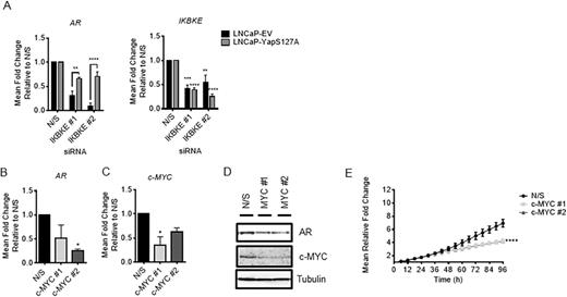 IKBKE effects on AR expression are phenocopied by c-MYC knockdown and partially rescued by overexpression of constitutively active Yap. (A) LNCaP-EV and LNCaP-Yap-S127A were reverse transfected with two individual siRNA sequences targeting IKBKE. RNA was collected after 72 h and assessed for expression of AR and IKBKE by qPCR (n = 3). (B) LNCaP cells were reverse transfected with either N/S or two independent siRNA sequences targeting c-MYC. After 72 hours, RNA was collected and AR mRNA and (C) c-MYC expression levels determined by QPCR (n = 3). One-way ANOVA, Dunnett's multiple comparisons test * P < 0.05, ** P < 0.01, *** P < 0.001, **** P < 0.0001. (D) Concurrently, protein lysates were also collected and tested for AR and c-MYC expression by western blotting. (E) LNCaP cells were reverse transfected in full media with either N/S or two independent siRNA sequences targeting c-MYC and cell confluency assessed using the IncuCyte Zoom Live Cell Imager every 6 h for 96 h (n = 3). 2way ANOVA, Dunnett's multiple comparisons test **** P < 0.0001.