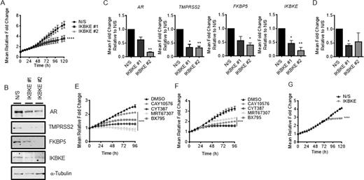 IKBKE is required for AR-target gene expression and cell growth in treatment-resistant PC cells. (A) LNCaP-EnzR cells were reverse transfected in full media with either N/S or two independent siRNAs against IKBKE and cell confluency assessed using the IncuCyte Zoom Live Cell Imager every 6 h for 96 h (n = 3). (B) LNCaP-EnzR cells were treated as in (A) after 96 h, AR, TMPRSS2, FKBP5 and IKBKE expression was determined by immunoblotting and (C) AR, TMPRSS2, FKBP5 and IKBKE mRNA expression determined by qPCR (n = 3). (D) LNCaP-EnzR cells were transfected in full media with either N/S or three pooled siRNAs against IKBKE. After 72 h, cells were re-seeded at a density of 2000 cells per well and cultured for 2 weeks. Colony forming efficiency was assessed by fixing and staining colonies with crystal violet (n = 3). (E) LNCaP-EnzR cells were seeded and left to adhere and grow for 24 h, prior to treatment with either vehicle (DMSO) or the IKBKE antagonists, CAY10576 (5 μM), BX795 (5 μM), MRT67307 (5 μM), or CYT387 (5 μM) and cell confluency assessed using the IncuCyte Zoom Live Cell Imager every 6 h for 96 h (n = 2). (F) CWR22Rv1 cells were seeded and left to adhere and grow for 24 h, prior to treatment with either vehicle or CAY10576 (5 μM), BX795 (5 μM), MRT67307 (5 μM), or CYT387 (5 μM) and cell confluency assessed using the IncuCyte Zoom Live Cell Imager every 6 h for 96 h (n = 2). (G) CWR22Rv1 cells were reverse transfected with either N/S or three pooled siRNAs against IKBKE, in full media supplemented with 10 μM Enz and cell confluency assessed using the IncuCyte Zoom Live Cell Imager every 6 h for 120 h (n = 3). 2way ANOVA, Dunnett's multiple comparisons test used in A, E, F and G **** P < 0.0001. One-way ANOVA paired Dunnetts multiple comparison test used in C and D * P < 0.05, ** P < 0.001.