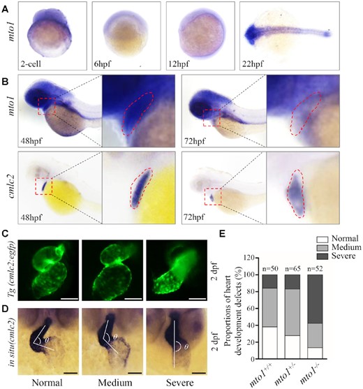 Heart development defects in zebrafish. (A) Whole-mount in situ hybridization (WISH) analysis of mto1 expression on wild type larval zebrafish at various ages (2-cell to 24 hpf). (B) WISH analysis of mto1 on wild type larval zebrafish at 48 hpf and 72 hpf. cmlc2 marker was used to indicate the place of heart. Insets show higher magnifications of heart. (C) Tg (cmlc2:egfp) embryos at 2 dpf shows the heart-restricted GFP expression in both chambers. Scale bars: 50 μm. (D) WISH against cmlc2. According to the looping state, measured by the angles between ventricle and atrium, hearts were divided into normal (α < 90°), medium (90° < α < 180°), and severe (α > 180°). Scale bars: 50 μm. (E) The proportions of each phenotypes in the embryos in mutant and WT zebrafish.