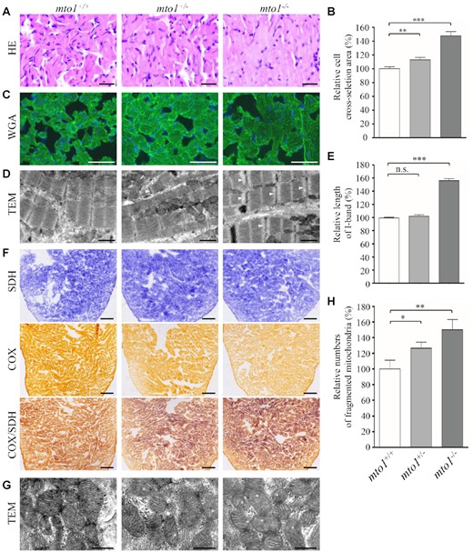 Hypertrophic cardiomyopathy and mitochondrial defects in the zebrafish. (A) Hematoxylin and eosin stained (H&E) histological sections of hearts from mto1−/−, mto1+/− and mto1+/+ zebrafish at the age of 6 months. Scale bars: 20 μm. (B) The relative cross-sectional areas of cardiomyocytes in the mto1+/+ (n = 104), mto1+/− (n = 112), mto1−/− (n = 92) zebrafishes, staining with H&E. (C) The cardiomyocytes from mutant and WT zebrafishes were visualized via WGA staining. Scale bars: 20 μm. (D) Ventricular heart muscle sections of transmission electron microscopy in the mutant and WT zebrafish. Ultrathin sections were visualized with 15 000× magnifications. Widened I-band in the sarcomere units were indicated by white arrowhead. Scale bars: 1 μm. (E) Quantification of the I-band lengthes of mto1+/+ (n = 28), mto1+/− (n = 18) and mto1−/− (n = 29) zebrafish. The values for the mutants were expressed as percentages of the mean values for the WT. (F) Assessment of mitochondrial functions in cardiomyocytes by enzyme histochemistry (EHC) staining for cytochrome c oxidase (COX) and succinate dehydrogenase (SDH) in the frozen-sections of ventricles in the mto1−/−, mto1+/− and mto1+/+ zebrafish at six-month old. Scale bars: 50 μm. (G) Mitochondrial networks from cardiomyocytes of transmission electron microscopy. Ultrathin sections were visualized with 30 000× magnifications. Fragmented mitochondria are indicated by asterisks. Scale bars: 0.5 μm. (H) Quantifications of fragmented mitochondria numbers of cardiomyocytes from the mto1−/−, mto1+/− and mto1+/+ zebrafish. The error bars indicate standard deviations of the means. P indicates the significance, according to Student's t test, of the difference between mto1+/− or mto1−/− and WT values, denoted by asterisks (*P< 0.05, **P< 0.01, ***P< 0.001), and non-significant differences by n.s.