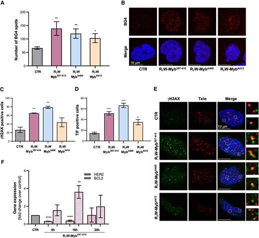 Mechanism of action of the selected peptides. (A, B) U2OS cells were subjected to 24 h of treatment with 10 μM of R7W-Myb397–415, R7W-MybA400 and R7W-MybA412 and G4-stabilizing activity was evaluated by IF confocal microscopy through the use of an antibody (BG4) able to specifically recognize G4 structures in cells. (A) Histograms showing the number of BG4 spots in treated over untreated (CTR) samples. Mean ± SD of three independent experiments performed in triplicate is shown; *P< 0.05, **P< 0.01. (B) Representative images of confocal sections (63×) from (A). For each condition, G4 structures (red) and merged images of DAPI counterstained nuclei (blue) with G4s are shown. Scale bar (10 μm) is reported in the images. (C–E) U2OS cells, subjected or not to treatment with the indicated peptides (10 μM for 24 h), were processed for telomeric FISH combined with immunofluorescence analysis of γH2AX, a common marker of DNA damage. (C) Histograms showing the percentage of γH2AX-positive cells. (D) Quantitative analysis of the percentage of Telomere Induced Foci (TIF)-positive cells. Cells with at least four γH2AX/Telo colocalizations were scored as TIF positive. (E) Representative confocal microscopy images (63×) used for the quantitative analyses reported in (C) and (D). γH2AX spots (green), telomere probe spots (red), DAPI stained nuclei (blue) and merged images are shown. For each experimental condition, 4× enlargements of merged fields are reported. Scale bars are shown in the images. (F) U2OS cells were treated with 10 μM of R7W-Myb397–415 and the expression levels of HER2 and BCL-2 were evaluated by real-time RT-PCR, at the indicated time-points. Results are expressed as fold change of gene expression in treated cells over their control counterpart (CTR). All the histograms show the mean ± SD of at least three independent experiments performed in triplicate; *P< 0.05, **P< 0.01, ***P< 0.001, ****P< 0.0001.