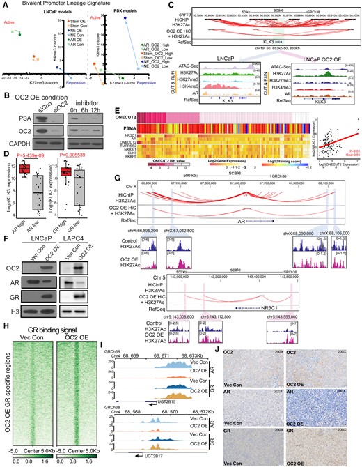 OC2 activates AR-bypass pathways through GR. (A) Epigenetic status (H3K27me3 and H3K4me3 signal) of the promoters of a panel of lineage signature genes (AR/Stem/NE) represented by average z-score in LNCaP Vec Con and OC2 OE cells (left), and patient derived xenografts (PDX) with OC2 high and OC2 low phenotype (N = 3 for each). (B) OC2 knockdown with siRNA (10 uM) suppressed PSA in the OC2 OE condition, indicating OC2 in controls PSA-expressing lineage in OC2 OE cells. (C) Integrated analysis showed loss of enhancer looping to the KLK3 promoter with OC2 OE (Top). ATAC-seq and CUT&RUN-seq of H3K27Ac, H3K27me3, H3K4me3 and AR binding signals were aligned at KLK3 in LNCaP Vec Con and OC2 OE cells (Bottom). (D) KLK3 expression in AR and GR high versus low groups in SU2C cohorts. (E) mCRPC specimens (8) with evidence of AR activity, based on AR signature and positive PSMA staining, which show high OC2 expression, also exhibited either high AR or high GR expression (left). OC2 mRNA level is positively correlated with GR mRNA with Spearman's correlation coefficient (right). (F) OC2-induced GR upregulation with AR suppression in both LNCaP and LAPC4 cells. (G) Integrated HiC with H3K27Ac loops indicating enhancer regions near AR and NR3C1 (GR) promoter loci. (H) Normalized tag densities of CUT&RUN-seq at specific GR binding regions showed increased GR binding on the chromatin. (I) Loss of AR binding and gain of GR binding at the promoter loci of UGT2B15 and UGT2B17 in LNCaP OC2 OE cells. (J) OC2, AR and GR IHC staining in xenograft models created by subcutaneous injection of LNCaP Vec Con and OC2 OE cells.
