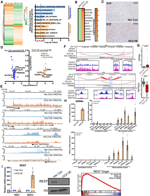 OC2 promotes neuroendocrine features through super-enhancer reprogramming. (A) OC2 signature genes derived from AR-dependent LNCaP cells (Left). And the Gene Set enrichment analysis of OC2 signature genes (Right). (B) Enforced OC2 expression upregulates multiple NE signature genes in LNCaP cells. Non-expressing genes were removed from the heatmap. (C) SYP IHC staining in LNCaP Vec Con and OC2 OE cells xenograft models. (D) Genes proximal to super-enhancer regions identified as newly formed in OC2 OE cells versus control cells with corresponding change in RNA level. (E) Visualization of H3K27Ac signals around TMPRSS2 / FOLH1 (encoding PSMA) and SRRM4 / CLIP2 are shown. (F) Integrated HiC and H3K27Ac signal showed enhancers looped to promoter loci of TMPRSS2 and SRRM4. (G) Expression of TMPRSS2 and SRRM4 in SU2C cohorts stratified by OC2 activity. (H) Upregulation of the splicing factor SRRM4 promotes neural-specific splicing variants with OC2 overexpression (unpaired two-tailed Student's t-test, **P < 0.01, *P< 0.05). (I) Master neuronal suppressor REST was suppressed in the nucleus (middle) through SRRM4-mediated spicing variant REST4 (left), which promotes NE differentiation (right).