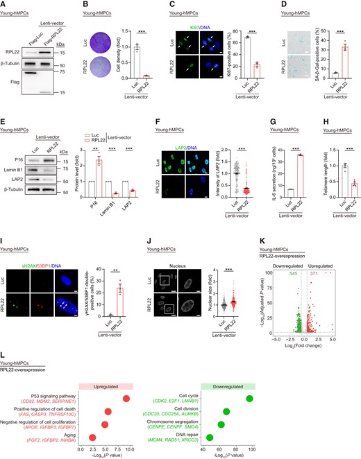 Overexpression of RPL22 accelerates hMPC senescence. (A) Western blot analysis of RPL22 protein level in young hMPCs transduced with lentiviruses expressing Flag-Luc or Flag-RPL22. β-Tubulin was used as loading control. (B) Clonal expansion analysis of young hMPCs transduced with lentiviruses expressing Luc or RPL22. Data are presented as the means ± SEMs. n = 3 biological replicates. Two-tailed unpaired Student's ttest was performed. (C) Immunostaining analysis of Ki67 in young hMPCs transduced with lentiviruses expressing Luc or RPL22. Scale bar, 10 μm. Data are presented as the means ± SEMs. n = 3 biological replicates. The white arrows indicate Ki67-positive cells. Two-tailed unpaired Student's t test was performed. (D) SA-β-Gal staining of young hMPCs transduced with lentiviruses expressing Luc or RPL22. Scale bar, 100 μm. Data are presented as the means ± SEMs. n = 3 biological replicates. Two-tailed unpaired Student's ttest was performed. (E) Western blot analysis of P16, Lamin B1 and LAP2 protein levels in young hMPCs transduced with lentiviruses expressing Luc or RPL22. β-Tubulin was used as loading control. Data are presented as the means ± SEMs. n = 3 biological replicates. Two-tailed unpaired Student's ttest was performed. (F) Immunostaining analysis of LAP2 in young hMPCs transduced with lentiviruses expressing Luc or RPL22. Scale bar, 10 μm. Data are presented as the means ± SEMs. n = 200 cells. Two-tailed unpaired Student'st test was performed. (G) ELISA analysis of IL-6 secretion in young hMPCs transduced with lentiviruses expressing Luc or RPL22. Data are presented as the means ± SEMs. n = 3 biological replicates. Two-tailed unpaired Student's t test was performed. (H) Real-time quantitative PCR (qPCR) analysis of telomere length in young hMPCs transduced with lentiviruses expressing Luc or RPL22. The expression level was normalized to 36B4. Data are presented as the means ± SEMs. n = 4 technical replicates. Two-tailed unpaired Student's t test was performed. Data are representative of three independent experiments. (I) Immunostaining analysis of γH2AX and 53BP1 in young hMPCs transduced with lentiviruses expressing Luc or RPL22. Scale bar, 5 μm. Data are presented as the means ± SEMs. n = 3 biological replicates. The white arrows indicate γH2AX and 53BP1-double-positive foci. Two-tailed unpaired Student's t test was performed. (J) Nuclear size of young hMPCs transduced with lentiviruses expressing Luc or RPL22. Scale bar, 20 μm (left) and 5 μm (right). Data are presented as the means ± SEMs. n = 200 cells. Two-tailed unpaired Student's t test was performed. (K) Volcano plot showing upregulated (red) or downregulated (green) DEGs in young hMPCs transduced with lentiviruses expressing RPL22 compared to Luc. (L) Dot plots showing GO terms and pathways associated with upregulated (red) and downregulated DEGs (green) in young hMPCs transduced with lentiviruses expressing RPL22 compared to Luc.