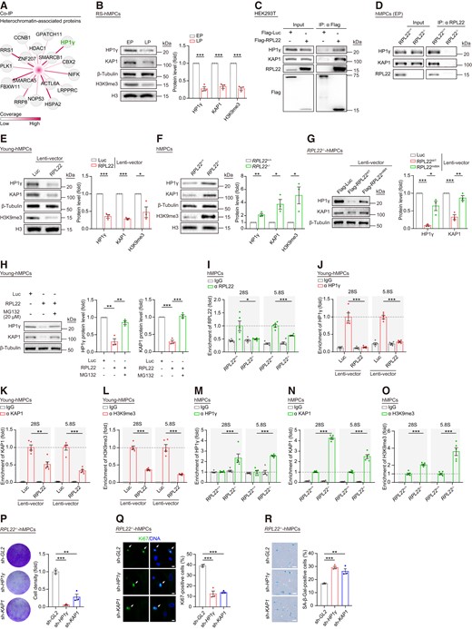 RPL22 binds rDNA and destabilizes HP1γ and KAP1 in senescent hMPCs. (A) Network diagram showing heterochromatin-associated proteins interacted with RPL22. The color key from white to red indicates coverage levels from low to high. (B) Western blot analysis of HP1γ, KAP1 and H3K9me3 protein levels in RS hMPCs. β-Tubulin was used as loading control for HP1γ and KAP1. Histone 3 (H3) was used as loading control for H3K9me3. Data are presented as the means ± SEMs. n = 3 biological replicates. Two-tailed unpaired Student's ttest was performed. (C) Co-IP analysis of the exogenous interaction between RPL22 and HP1γ or KAP1 in HEK293T cells transduced with Flag-Luc and Flag-RPL22. (D) Co-IP analysis showing that endogenous RPL22 is interacted with HP1γ or KAP1 in RPL22+/+ and RPL22-/- hMPCs at early passage (EP, P3). (E, F) Western blot analysis of HP1γ, KAP1 and H3K9me3 protein levels in young hMPCs transduced with lentiviruses expressing Luc or RPL22 (E) and in RPL22+/+ and RPL22-/- hMPCs (F). β-Tubulin was used as loading control for HP1γ and KAP1. Histone 3 (H3) was used as loading control for H3K9me3. Data are presented as the means ± SEMs. n = 3 biological replicates. Two-tailed unpaired Student's t test was performed. (G) Western blot analysis of HP1γ and KAP1 protein levels in RPL22-/- hMPCs transduced with lentiviruses expressing Luc, RPL22WT or RPL22m88A. β-Tubulin was used as loading control. Data are presented as the means ± SEMs. n = 3 biological replicates. Two-tailed unpaired Student's ttest was performed. (H) Western blot analysis of HP1γ and KAP1 protein levels in young hMPCs transduced with lentiviruses expressing Flag-Luc or Flag-RPL22 after treatment with or without MG132 (20 μM for 12 h). β-Tubulin was used as loading control. Data are presented as the means ± SEMs. n = 3 biological replicates. Two-tailed unpaired Student's ttest was performed. (I) Relative enrichment of RPL22 at rDNA regions in RPL22+/+ and RPL22-/- hMPCs. Data are presented as the means ± SEMs. n = 5 technical replicates. Two-tailed unpaired Student's ttest was performed. Data are representative of three independent experiments. (J–L) Relative enrichment of HP1γ (J), KAP1 (K) or H3K9me3 (L) at rDNA regions in young hMPCs transduced with lentiviruses expressing Luc or RPL22. Data are presented as the means ± SEMs. n = 5 technical replicates. Two-tailed unpaired Student's ttest was performed. Data are representative of three independent experiments. (M–O) Relative enrichment of HP1γ (M), KAP1 (N) or H3K9me3 (O) at rDNA regions in RPL22+/+ and RPL22-/- hMPCs. Data are presented as the means ± SEMs. n = 5 technical replicates. Two-tailed unpaired Student's t test was performed. Data are representative of three independent experiments. (P) Clonal expansion analysis of RPL22-/- hMPCs transduced with lentiviruses expressing sh-GL2, sh-HP1γ or sh-KAP1. Data are presented as the means ± SEMs. n = 3 biological replicates. Two-tailed unpaired Student's ttest was performed. (Q) Immunostaining analysis of Ki67 in RPL22-/- hMPCs transduced with lentiviruses expressing sh-GL2, sh-HP1γ or sh-KAP1. Scale bar, 10 μm. Data are presented as the means ± SEMs. n = 3 biological replicates. The white arrows indicate Ki67-positive cells. Two-tailed unpaired Student's t test was performed. (R) SA-β-Gal staining of RPL22-/- hMPCs transduced with lentiviruses expressing sh-GL2, sh-HP1γ or sh-KAP1. Scale bar, 100 μm. Data are presented as the means ± SEMs. n = 3 biological replicates. Two-tailed unpaired Student's t test was performed.