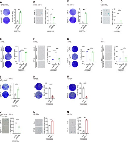 RPL22 depletion counteracts senescence of human cells. (A, C) Clonal expansion analysis of HGPS (A) and WS (C) hMPCs at late passage (P8) after lentivirus-mediated CRISPR knock-out with sgRPL22. Data are presented as the means ± SEMs. n = 3 biological replicates. Two-tailed unpaired Student's t test was performed. (B, D) SA-β-Gal staining of HGPS (B) and WS (D) hMPCs at late passage (P8) after lentivirus-mediated CRISPR knock-out with sgRPL22. Scale bar, 100 μm. Data are presented as the means ± SEMs. n = 3 biological replicates. Two-tailed unpaired Student's ttest was performed. (E, G) Clonal expansion analysis of UV- (E) or H2O2- (G) induced hMPC senescence after lentivirus-mediated CRISPR knock-out with sgRPL22. Data are presented as the means ± SEM. n = 3 biological replicates. Two-tailed unpaired Student's ttest was performed. (F, H) SA-β-Gal staining of UV- (F) or H2O2- (H) induced hMPC senescence after lentivirus-mediated CRISPR knock-out with sgRPL22. Scale bar, 100 μm. Data are presented as the means ± SEMs. n = 3 biological replicates. Two-tailed unpaired Student's ttest was performed. (I, K, M) Clonal expansion analysis of aged primary hMPCs (I) after lentivirus-mediated CRISPR knock-out with sgRPL22, hCAECs (K) and hUVECs (M) transduced with lentiviruses expressing Luc or RPL22. Data are presented as the means ± SEMs. n = 3 biological replicates. Two-tailed unpaired Student's ttest was performed. (J, L, N) SA-β-Gal staining of aged primary hMPCs (J) after lentivirus-mediated CRISPR knock-out with sgRPL22, hCAECs (L) and hUVECs (N) transduced with lentiviruses expressing Luc or RPL22. Scale bar, 100 μm. Data are presented as the means ± SEMs. n = 3 biological replicates. Two-tailed unpaired Student's t test was performed.