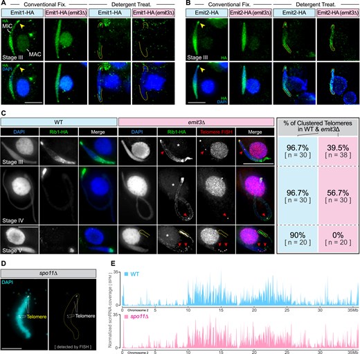 Emit3 is required for the localization of MIC ncRNA transcription regulators. (A) Immunostaining of endogenously expressed Emit1-HA in WT and emit3Δ cells that were fixed under different conditions. Arrowheads indicate eye-catching telomeric clustered regions in the MIC. Dashed lines indicate MIC termini. Scale bar: 10 μm. (B) Immunostaining of endogenously expressed Emit2-HA in WT and emit3Δ cells that were fixed under different conditions. Arrowheads indicate the telomeric clustered regions in the MIC. Dashed lines indicate MIC termini. Scale bar: 10 μm. (C) Immunostaining of endogenously expressed Rib1-HA in WT and emit3Δ cells. Telomeric repeats were stained using FISH. Arrowheads denote telomeric foci. Scale bar: 10 μm. (D) FISH staining of telomeric repeats in spo11Δ meiotic MIC. Scale bar: 10 μm. (E) The abundance profiles of scnRNAs on chromosome 2 of the meiotic MIC in WT and spo11Δ cells. BPM: Bins per million mapped reads.