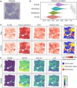 STAGE enables robust cell type prediction and tissue domain segmentation in...