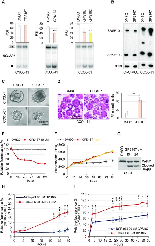 Impact of GPS167 on colorectal organoids. (A) RT-PCR assay to monitor BCLAF1 alternative splicing of exon 5a in the normal (CNOL-11) or cancer (CCOL-01 and CCOL-11) colorectal organoid lines in the presence or the absence of 10 μM of GPS167 or GPS192. (B) Impact of GPS167 on the expression of SRSF10. Immunoblotting was used to detect SRSF10 proteins in normal (CRC-MOL) and cancer (CCOL-11) colorectal organoids treated or not with 10 μM of GPS167 for 72 h. The two forms of SRSF10 are indicated. (C) Representative images of a typical single normal (CNOL-11) or cancer (CCOL-11) organoid before and after treatment with GPS167 (or DMSO as control). (D) Haematoxylin and eosin staining of the cancer organoid line CCOL-11 that was treated or not with GPS167. The number of necrotic cells was estimated visually. Necrosis designates the presence of dead cells regardless of pre-lethal processes. (E) The Alamar Blue assay was used to monitor growth of GPS167-treated and untreated CCOL-11 cells. The values were normalized for untreated cells. (F) The CellTox-Green assay was used to monitor cytotoxicity of treated and untreated CRC organoids (CCOL-11). (G) A PARP cleavage assay was used to monitor apoptosis on the same samples as used in panel F. (H) Cytotoxicity assay monitoring the differential cytotoxic response of GPS167 relative to DMSO in normal organoids from a wild-type mouse (NOR-p74) or a cancerous organoid from a carcinoma developed in a Apcmin/+ mouse (TOR-706). (I) Cytotoxicity assay monitoring the differential cytotoxic response of GPS167 relative to DMSO in normal organoids from a wild-type mouse (NOR-p74) or a cancerous organoid from a mouse colorectal tumor induced by azoxymethane/dextran sodium sulfate (TOR-L1). Asterisks indicate statistical significance (***P< 0.001, **P< 0.01, *P< 0.05). Multiple t-tests and n = 5 technical replicates were performed for panels H and I; n = 3 for the others.