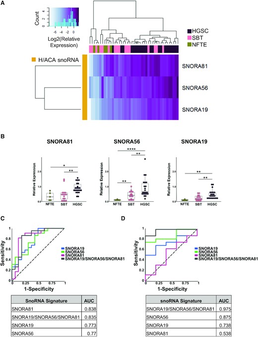 Validation of the snoRNA signature using independent set of normal, borderline, and high-grade tumour tissues. (A) The relative abundance of the three snoRNAs forming the HGSC signature identified in Figure 3 were examined in an independent mix of 43 tissues (22 HGSC, 16 SBT and 5 NFTE) using RT-qPCR. The log2 of the relative expression is presented as a clustered heatmap. The snoRNA names are indicated on the right and the identity of the tissue of origin is indicated on top. The key for the colored gradient is shown on the top left. (B) Comparison between the distributions of the abundance of the snoRNA from the signature in 5 NFTE, 16 SBT and 22 HGSC tissues. The abundance of the snoRNAs was determined as described in A. Each point in the box plot represents one tissue and the data obtained from NFTE, SBT and HGSC are shown in green, pink, and purple, respectively. The stars indicate P-values from Tukey tests from left to right of 0.04 (*), 0.002 (**), 0.004 (**), 8E-07 (****), 0.003 (**), 0.002 (**), 0.006 (**). (C) The snoRNA signature and its snoRNA components may discriminate between HGSC and SBT. On the top panel, the ROC curves of the discriminatory capacity of the three individual snoRNAs and the combination signature. On the bottom panel, the table of the area under the ROC curve (AUC) for individual snoRNAs and the combination. (D) The snoRNA signature improves the discrimination between SBT and NFTE tissues. The top and bottom panels are as described in C.