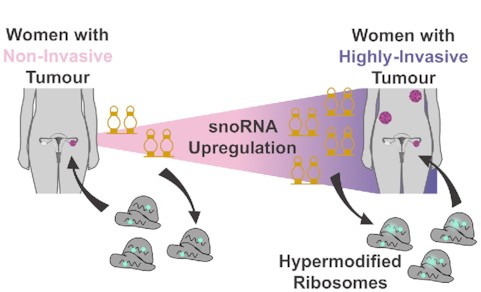 Identification H/ACA snoRNA signature of high-grade serous ovarian cancer.