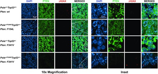 Pten mutations have different effects on Pten subcellular localization and DNA damage levels in mouse tumors. Tumors from mice with the indicated Pole and Trp53 genotypes and somatic Pten mutations were processed and stained for DAPI (blue) and Pten (green) and γ-H2AX (red). Shown are representative confocal images at 10× magnification and zoomed-in insets.