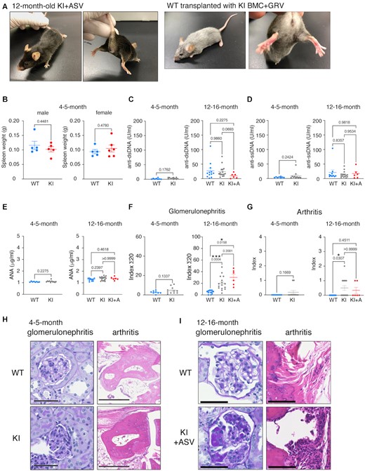 Analyses of autoimmune disease-like symptoms in KI mice with or without injection of asunaprevir (ASV) or grazoprevir (GRV). (A) Appearance of 12-month-old KI mouse treated with ASV at the age of 4 months. (B) Spleen weight of 4–5-month-old male and female WT (light blue, n = 5) and KI (red; males, n = 5; females, n = 6) mice. (C–E) Autoantibody titers in the sera of WT, KI and KI + ASV mice measured using ELISA. Anti-double strand (ds) DNA antibody (C), anti-single strand (ss) DNA antibody (D) and anti-nucleus antibody (ANA) (E) were quantified. Four- to five-month-old mice: WT, n = 8; KI, n = 11. Twelve- to 16-month-old mice: WT, n = 12 (C), n = 10 (D, E); KI, n = 16; KI + ASV, n = 6. (F, G) Scores of histological analyses of autoimmune diseases in 4–5-month- and 12–16-month-old WT (blue), KI (grey), or KI + ASV (red) mice. Four- to five-month-old mice: WT, n = 8; KI, n = 11. Twelve- to sixteen-month-old mice: WT, n = 12; KI, n = 16; KI + ASV, n = 6. Data are represented as mean ± SE. (H, I) Photomicrographs of histopathological manifestations in 4–5-month-old (H) and 12–16-month-old (i) mice analyzed in (E). Pictures show the most severe parts of each stage. Scale bars: 50 μm for glomerulonephritis, 500 μm for arthritis. P values obtained by unpaired two-tailed t-tests (4–5-month) and Brown-Forsythe Welch ANOVA tests (12–16-month) were shown in the graph. *P < 0.05; ***P < 0.001.