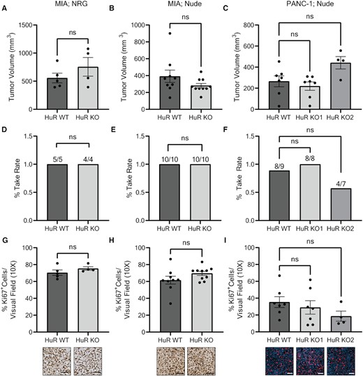 Loss of HuR in PDAC cells does not impact tumor size or proliferation in an orthotopic xenograft model. Tumor volumes of (A) MIA tumors in NRG mice, (B) MIA tumors in nude mice and (C) PANC-1 tumors in nude mice. Each data point represents a separate tumor. Tumor take rate of (D) MIA tumors in NRG mice, (E) MIA tumors in nude mice and (F) PANC-1 tumors in nude mice. Quantification of % Ki67+ cells per visual field imaged at 10× for (G) MIA tumors in NRG mice, (H) MIA tumors in nude mice and (I) PANC-1 tumors in nude mice. Each data point represents the average of at least five images per tumor stained for Ki67. Representative images are found below the corresponding bar graph. Statistical analysis was performed using a Student’s two-sample t-test for all panels, except panels (C), (F) and (I) that were performed using one-way ANOVA. Error bars represent standard error of the mean. ns, not significant. Scale bars represent 50 μm.