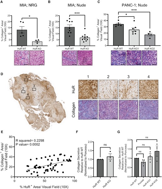 Loss of HuR results in decreased collagen deposition, independent of tumor cell collagen secretion. (A–C) Quantification of % collagen+ area per visual field imaged at 10×. Each data point represents the average of at least five images per tumor stained for collagen via trichrome. Representative images are found below the corresponding bar graph. Tumors analyzed were from the orthotopic model of (A) MIA cells injected in NRG mice, (B) MIA cells injected in nude mice or (C) PANC-1 cells injected in nude mice. Statistical analysis was performed using a Student’s two-sample t-test for panels (A) and (B), and one-way ANOVA for panel (C). (D) Representative whole tumor image of PANC-1 Pooled tumors stained for HuR expression. Subset images to the right show HuR and collagen expression of the same area, imaged at 10×. (E) Quantification of % collagen+ area and % HuR+ area in the same visual field imaged at 10× of PANC-1 Pooled tumors (n = 8) in nude mice. Statistical analysis was performed using Pearson’s correlation. (F) Quantification of collagen secreted from MIA PaCa-2 HuR WT and HuR KO cells in vitro. Statistical analysis was performed using a Student’s two-sample t-test. (G) Quantification of collagen secreted from PANC-1 HuR WT, Pooled and HuR KO cells in vitro. Statistical analysis was performed using a one-way ANOVA. Collagen quantification is normalized to Ponceau stain and relative to HuR WT collagen secretion. Error bars represent standard error of the mean. ****P < 0.0001, ***P < 0.001, **P < 0.01 and *P < 0.05; ns, not significant. Scale bars represent 50 μm.