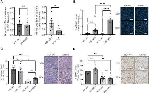 Loss of HuR sensitizes PDAC tumors to GEM treatments. (A) Tumor volumes of orthotopic PANC-1 HuR WT or HuR KO2 tumors from mice treated with either saline (VEH) or 50 mg/kg GEM twice a week. Tumor volumes are normalized to VEH treatment for each cell line. Statistical analysis was performed using a Student’s two-sample t-test. Quantification of (B) % γH2AX+ area, (C) % collagen+ area and (D) % αSMA+ area per visual field imaged at 10× of tumors from panel (A). Each data point represents the average of at least five images per tumor. Statistical analysis was performed using a one-way ANOVA. Error bars represent standard error of the mean. ****P < 0.0001, ***P < 0.001, **P < 0.01 and *P < 0.05, ns, not significant. Scale bars represent 50 μm.