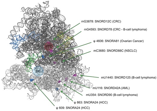 Localization of the modification sites in the 80S ribosome structure targeted by snoRNAs dysregulated in cancer. The structure of 80S ribosome (PDB entry 6QZP) shows only RNAs: 18S (light grey), 28S (dark grey), 5.8S (yellow), 5S (blue) and tRNA (green). Pseudouridine positions modified by the relevant H/ACA box snoRNAs are depicted as blue spheres, while 2′-O-methylation sites modified by C/D box snoRNA are depicted as pink spheres. PTC: peptidyltransferase centre; DC: decoding centre; CRC: colorectal cancer; NSCLC: non-small cell lung cancer; AML: acute myeloid leukemia; HCC: hepatocellular carcinoma.