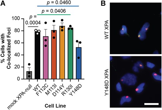 Recruitment to sites of UV damage is hindered for Y148D XPA tumor variant. (A) Local UV irradiation and immunofluorescence assay in stable XP2OS cell lines (n = 3). Cells were exposed to 120 J/m2 UV irradiation through polycarbonate isopore membranes with 5 μm pores and XPA and 6–4PP damage foci were detected using immunofluorescence after 30 min incubation. XPA co-localization in at least 100 cells with 6–4PP foci was quantified per cell line using FIJI. Mean percent cells with co-localized foci were statistically compared in each variant-expressing cell line to WT using two-tailed unpaired t-tests, and comparisons to WT with P< 0.05 are indicated. (B) Representative merged images of local UV irradiation and immunofluorescence assay in stable XP2OS cell lines from (A). DAPI in blue, 6–4PP in red, XPA in green, strong co-localization in yellow. Scale bar 20 μm.