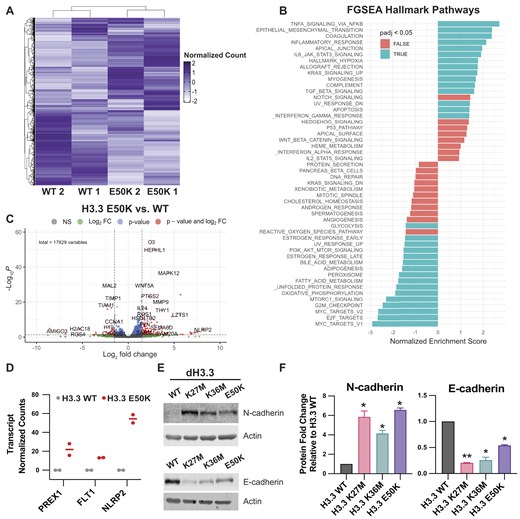 H3E50K supports an EMT gene expression program. (A) Gene cluster heatmap of HMECDD H3.3-TY1 and HMECDD H3.3E50K-TY1 cells from RNA-seq data showing differentially expressed genes. Z scores with normalized read counts were used for heatmap representation, n = 2. (B) FGSEA depicting upregulated or downregulated hallmark pathways from HMECDD H3.3E50K-TY1 cells compared with HMECDD H3.3-TY1 cells. (C) Enhanced volcano plot depicting significantly differentially expressed genes between HMECDD H3.3-TY1 cells and HMECDD H3.3E50K-TY1 cells, where P ≤ .05 (blue) and log2fold change ≥ 1.5 (red). (D) Normalized read counts of indicated EMT-associated genes that are upregulated in HMECDD H3.3E50K-TY1 cells compared with H3.3-TY1. (E) HMECDD cells stably transduced with the indicated plasmids and proteins extracted. Thirty micrograms of lysates were immunoblotted with the indicated antibodies. Representative images are shown, n = 2. (F) Quantification of the protein levels shown in panel (E) normalized to actin as a loading control.