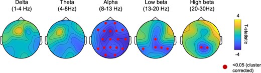EEG effects of 5-MeO-DMT. Ingestion of 5-MeO-DMT resulted in global reductions of alpha power across most electrodes, and decreases in posterior beta band power.