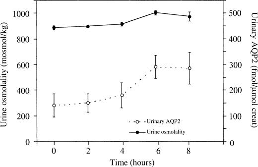 Effects of prolonged dehydration on urine osmolality and UAQP2. The first urine samples were collected after 12 h of thirsting (t=0 h). Both urine osmolality and UAQP2 increased significantly (P<0.05). There was no statistical relationship between urine osmolality and UAQP2 (P>0.05). Values are given as means±SEM.