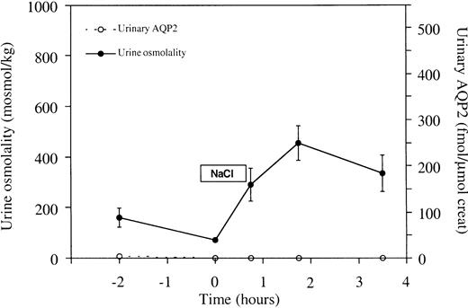 Effects of hypertonic saline infusion on urine osmolality and UAQP2. From t=0 to t=45 min, 700 ml NaCl 2.5% was infused. Urine osmolality rose significantly upon saline infusion (P<0.05). However, during the test no major change in UAQP2 was observed. No statistically significant relationship was found between urine osmolality and UAQP2 (P>0.05). Values are given as means±SEM.