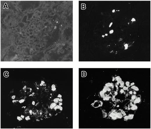 Grading samples of IgA1 deposits in rat glomeruli by immunofluorescence: (A) −; (B) +; (C) ++; (D) +++ (original magnification ×350).
