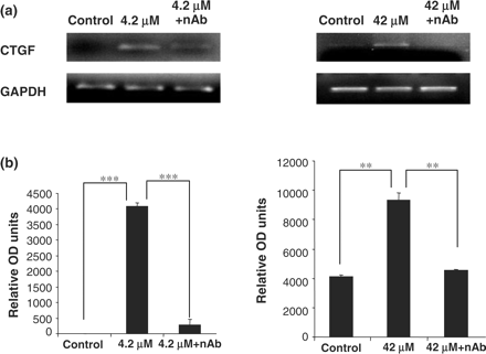 Influence of TGF-β1 neutralizing antibody on CsA induced CTGF gene expression in HK-2 cells. Cells were grown to confluency on 35 mm Petri dishes and treated with 4.2 and 42 μM CsA with or without TGF-β1 neutralizing antibody. TGF-β1 neutralizing antibody was diluted in culture medium to a concentration of 30 µg/ml. The cells were pre-treated with the neutralizing antibody for 1 h prior to CsA treatment or were treated with CsA alone for 48 h. CTGF and GAPDH mRNA levels were analysed in total RNA purified from the treated HK-2 cells. (a) Ethidium bromide-stained 1% agarose gels containing 10 μl of each PCR after electrophoresis. Treatments were 4.2 and 42 μM CsA for 48 h. The pictures are representative of at least three independent experiments performed in duplicate. (b) Band intensity was quantified using densitometry. Results are expressed as relative optical density units, which are proportional to the absorbance of the bands and are given as mean ± SEM of three independent experiments, each performed in duplicate. *P<0.05, **P<0.01, ***P<0.001.