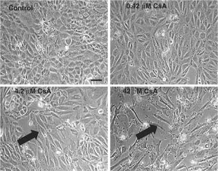 Effect of CsA treatment on HK-2 cellular morphology. Cells were grown to confluency and treated with varying doses of CsA for 48 h. Cell were visualized using phase contrast microscopy. The pictures are representative of at least three independent experiments performed in duplicate. Arrows indicate the presence of elongation/filopodia. Original magnification, 200×. Calibration bar, 10 µm.