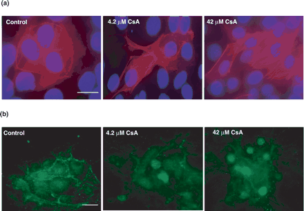 Immunofluorescent microscopy of F-actin distribution and β-catenin staining in HK-2 cells treated with varying concentrations of CsA. HK-2 cells were grown on glass slides for 24 h and subsequently treated with 4.2 μM cyclosporine A for a further 48 h. (a) The cells were stained with rhodamine phalloidin to highlight F-actin distribution and DAPI for nuclear localisation. Original magnification, 600×. (b) The cells were stained with β-catenin antibody to indicate β-catenin localization in the cells. Original magnification, 400×. The pictures are representative of at least three independent experiments performed in duplicate. Calibration bar, 10 µm.
