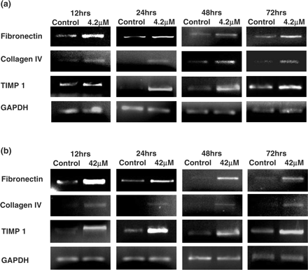 Influence of CsA on extracellular matrix component regulation in HK-2 cells. Cells were grown to confluency on 35 mm Petri dishes and treated with varying concentrations of CsA for varying lengths of time. Fibronectin, Collagen IV, TIMP 1 and GAPDH mRNA levels were analysed in total RNA purified from the treated HK-2 cells. Shown are pictures of ethidium bromide-stained 1% agarose gels containing 10 μl of each PCR after electrophoresis. (a) 4.2 μM CsA treatment. (b) 42 μM CsA treatment. The pictures are representative of at least three independent experiments performed in duplicate.