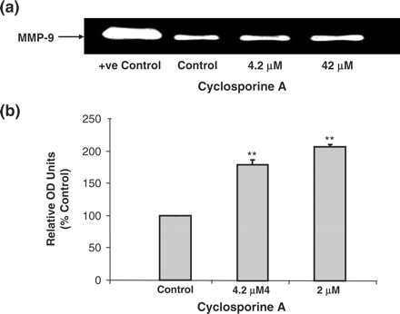 Gelatin zymography analysis of MMP-9 protein activity in HK-2 cells. Cells were treated with varying concentrations of CsA for 48 h. Proteins were run on a 12% SDS–PAGE gel. (a) Gelatinolytic activity of MMP-9 was detected by electrophoresis in acrylamide gels copolymerized with gelatin. Clear zones of gelatin lysis against blue background, following Coomasie blue staining, indicate the presence of gelatinolytic enzymes. A positive control for MMP-9 activity was also used. The blot is representative of at least three independent experiments performed in duplicate. (b) Clear zones were quantified using densitometry. Results are expressed as relative OD units, which are proportional to the absorbance of the bands and are the mean ± SEM of three independent experiments each performed in duplicate. *P<0.05, **P<0.01, ***P<0.001.