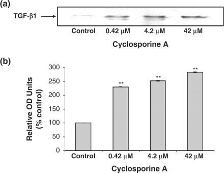 Western blot analysis of TGF-β1 protein expression in HK-2 cells. Cells were treated with varying concentrations of CsA for 48 h. Proteins were run on a 12% SDS–PAGE gel. Levels of TGF-β1 were detected by western blotting. Bands corresponding to the molecular weight of TGF β (25 kDa) were detected as shown by arrow. (a) Western blot of TGF-β1. The blot is representative of at least three independent experiments performed in duplicate. (b) Band intensity was quantified using densitometry. Results are expressed as % control at time zero and are given as the mean ±SEM of three independent experiments each performed in duplicate. *P<0.05, **P<0.01, ***P<0.001.
