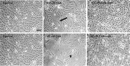 Comparison of the effect of the addition of CsA±TGF-β1 neutralizing antibody to HK-2 cellular morphology. HK-2 cells were treated at confluency for 48 h with 4.2 μM CsA±pre-treatment with 30 µg/ml of TGF-β1 neutralizing antibody. The cells were pre-treated with the neutralizing antibody for 1 h prior to CsA treatment or were treated with CsA alone for various time points. Cells were visualized using phase contrast microscopy. The pictures are representative of at least three independent experiments performed in duplicate. Arrows indicates the presence of elongation/filopodia. Original magnification, 200×. Calibration bar, 10 µm.