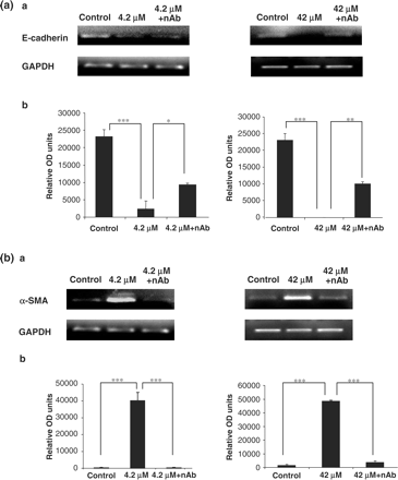 (a) Influence of TGF-β1 neutralizing antibody on cyclosporine abrogation of E-cadherin gene expression in HK-2 cells. Cells were grown to confluency on 35 mm Petri dishes and treated with 4.2 μM CsA with or without TGF-β1 neutralizing antibody. TGF-β1 neutralizing antibody was diluted in culture medium to a concentration of 30 µg/ml. The cells were pre-treated with the neutralizing antibody for 1 h prior to CsA treatment or were treated with CsA alone for 48 h. E-cadherin and GAPDH mRNA levels were analysed in total RNA purified from the treated HK-2 cells. (a) Ethidium bromide-stained 1% agarose gels containing 10 μl of each PCR after electrophoresis. Treatments were 4.2 and 42 μM CsA for 48 h. The pictures are representative of at least three independent experiments performed in duplicate. (b) Band intensity was quantified using densitometry. Results are expressed as relative optical density units, which are proportional to the absorbance of the bands and are given as mean ± SEM of three independent experiments, each performed in duplicate. *P<0.05, **P<0.01, ***P<0.001. (b) Influence of TGF-β1 neutralizing antibody on CsA induction of α-SMA gene expression in HK-2 cells. Cells were grown to confluency on 35 mm Petri dishes and treated with 4.2 and 42 μM CsA with or without TGF-β1 neutralizing antibody. TGF-β1 neutralizing antibody was diluted in culture medium to a concentration of 30 µg/ml. The cells were pre-treated with the neutralizing antibody for 1 h prior to CsA treatment or were treated with CsA alone for48 h. α-SMA and GAPDH mRNA levels were analysed in total RNA purified from the treated HK-2 cells. (a) Ethidium bromide-stained 1% agarose gels containing 10 μl of each PCR after electrophoresis. Treatments were 4.2 and 42 μM CsA for 48 h. The pictures are representative of at least three independent experiments performed in duplicate. (b) Band intensity was quantified using densitometry. Results are expressed as relative optical density units, which are proportional to the absorbance of the bands and are given as mean ± SEM of three independent experiments, each performed in duplicate. *P<0.05, **P<0.01, ***P<0.001.