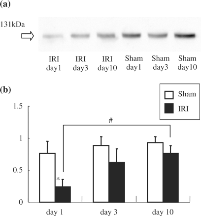 Klotho protein expression in the kidney after IRI operation. (a) Representative Western blotting. (b) Summary of the Western blot data. Klotho protein expression was significantly reduced in IRI rats at day 1. Data are given as means ± SD. *P<0.01 compared with sham operated-rats. #P<0.05 compared with day 10. (n = 4 for each group.)