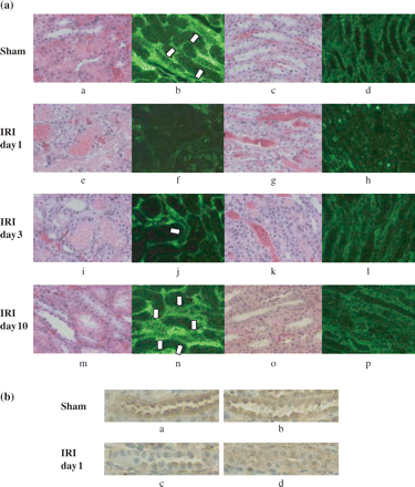 Representative immunohistochemical staining shows klotho expression in renal tubules. Sections for immunohistochemistry are presented with HE-stained paraffin sections for orientation. (a) The staining intensity was significantly reduced in IRI rats at day 1. The intensity was apparently improved at day 10. a–d; Sham, e–h; IRI day 1, i–l; IRI day 3, m–p; IRI day 10. a, b, e, f, i, j, m, n; cortex, c, d, g, h, k, l, o, p; medulla. a, c, e, g, i, k, m, o; HE staining (paraffin sections), b, d, f, h, j, l, n, p; klotho immunohistochemical staining. Arrow: klotho positive tubular cells. d, s: Most of the tubular cells in the medulla were klotho positive. (b) Representative immunohistochemical staining for klotho expression in paraffin sections. Klotho staining is seen mainly in distal tubular cells and the collecting duct. The staining was diminished in IRI at day 1, as shown by the frozen sections. a, b; Sham day 1, c, d; IRI day 1, a, c; cortex, b, d; medulla (×200).